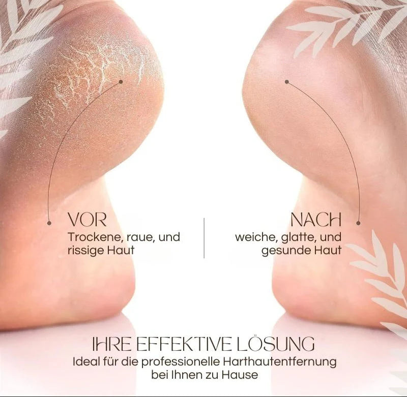 Pediluxe™ – Sanfte Füße in Minuten, ganz ohne Mühe!