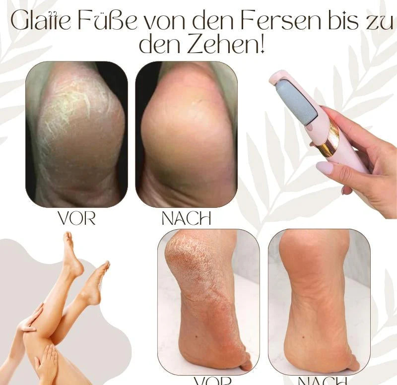 Pediluxe™ – Sanfte Füße in Minuten, ganz ohne Mühe!