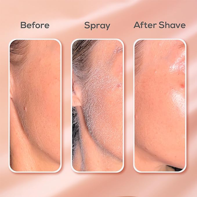 1+1 Gratis | SprayNova™ Spray zur Haarentfernung im Gesicht