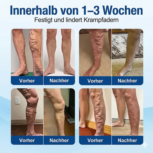 VeinTarget Mikronadelpflaster + 10-IN-1 𝗙ortschrittliches 𝗡ano-Mikronadel-𝑷𝒇𝒍𝒂𝒔𝒕𝒆𝒓 -Für weniger Schmerzen und Schwellungen, reduzierte Äderchen und stärkt die Gefäße