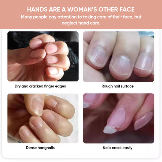 Seranail – Nagel- und Nagelhautpflegeöl