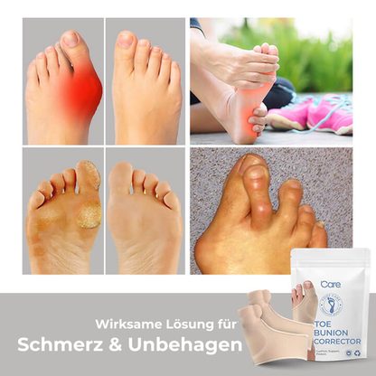 Footalis ZehAlign | Zehenspreizer für Hallux Valgus | Hautfreundlich & Diskret | Für Tag & Nacht