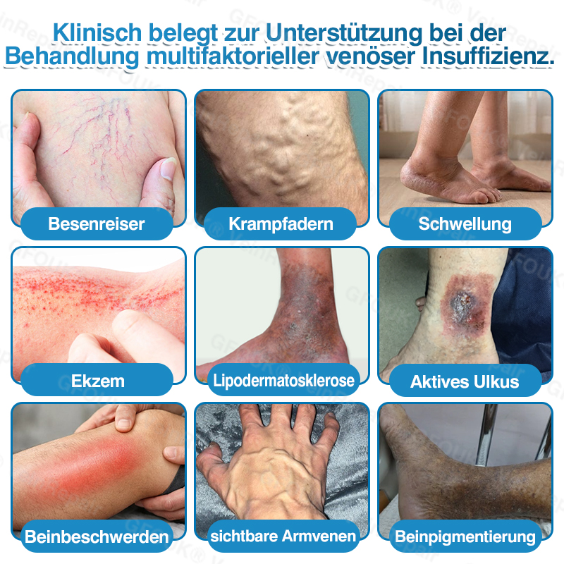 GFOUK® VeinRepair Mikronadel-Pflasterrolle⚡
