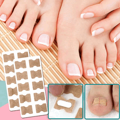 FinePatches – Nagelpflegepflaster