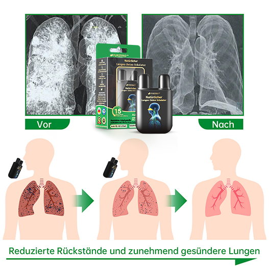 Furzero™ - Natürlicher Lungen-Detox-Inhalator