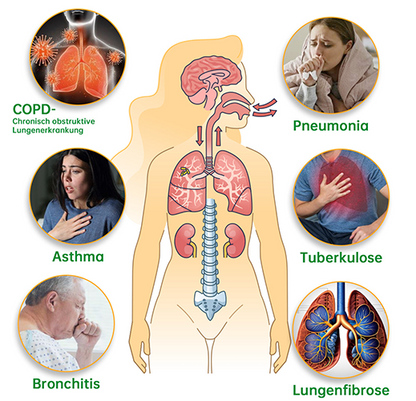 Furzero™ - Natürlicher Lungen-Detox-Inhalator
