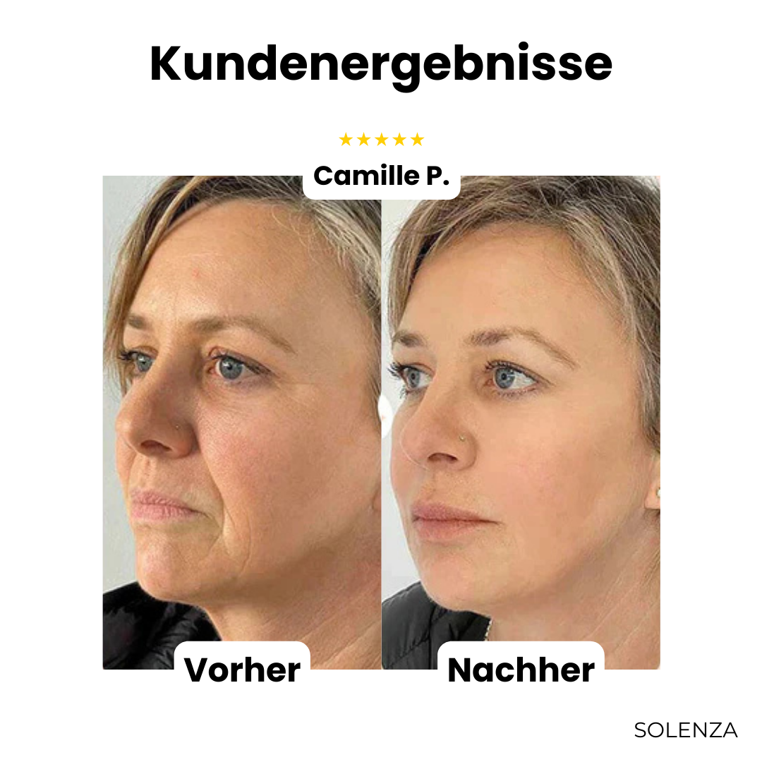 Letzter Tag -50% | GlowLuxe™ Anti-Falten-Balsam