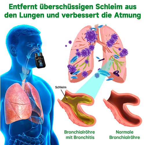 Furzero™ - Natürlicher Lungen-Detox-Inhalator