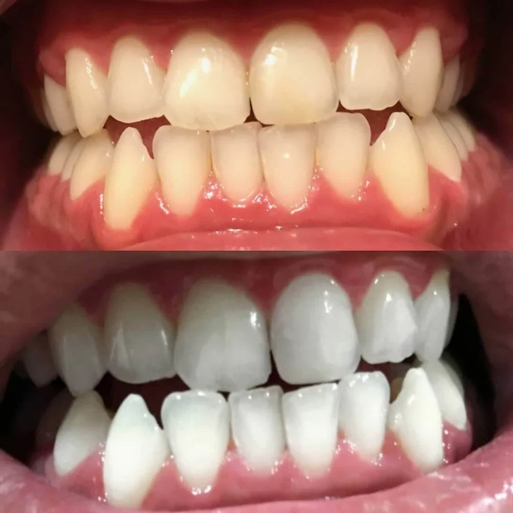 DrSmile™ – Strahlen Sie mit einem Lächeln, das jeden Raum beherrscht [1 + 1 Gratis]