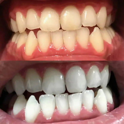 DrSmile™ – Strahlen Sie mit einem Lächeln, das jeden Raum beherrscht [1 + 1 Gratis]