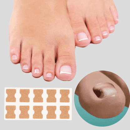 FinePatches – Nagelpflegepflaster
