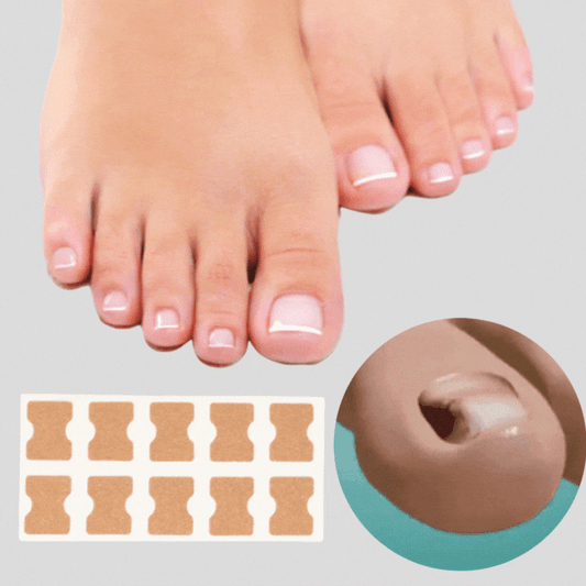 FinePatches – Nagelpflegepflaster