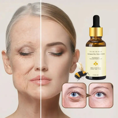Hochwirksames Bienengift-Serum | Sehen Sie in 7 Tagen 10 Jahre jünger aus!