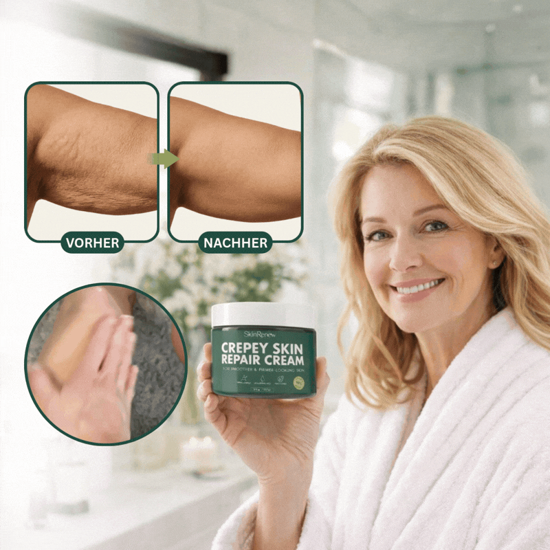 SkinRenew™ Reparaturcreme | Repariert schlaffe, alternde Haut in 14 Tagen