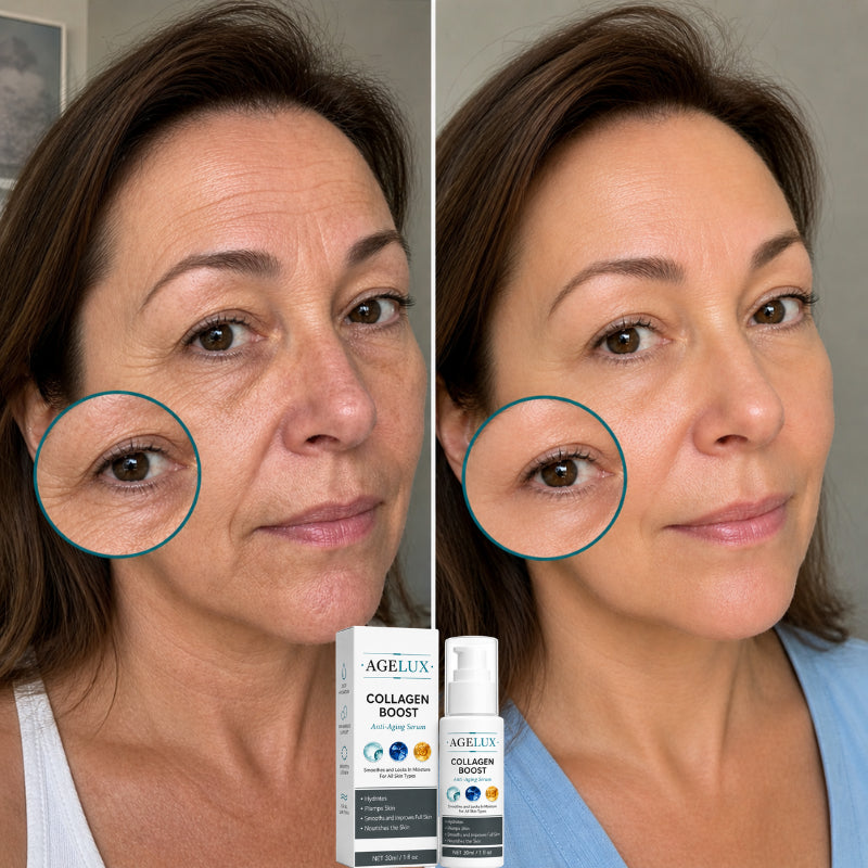 Agelux™ Collagen Boost Anti-Aging-Serum | Glätte Falten sichtbar in nur 3 Wochen