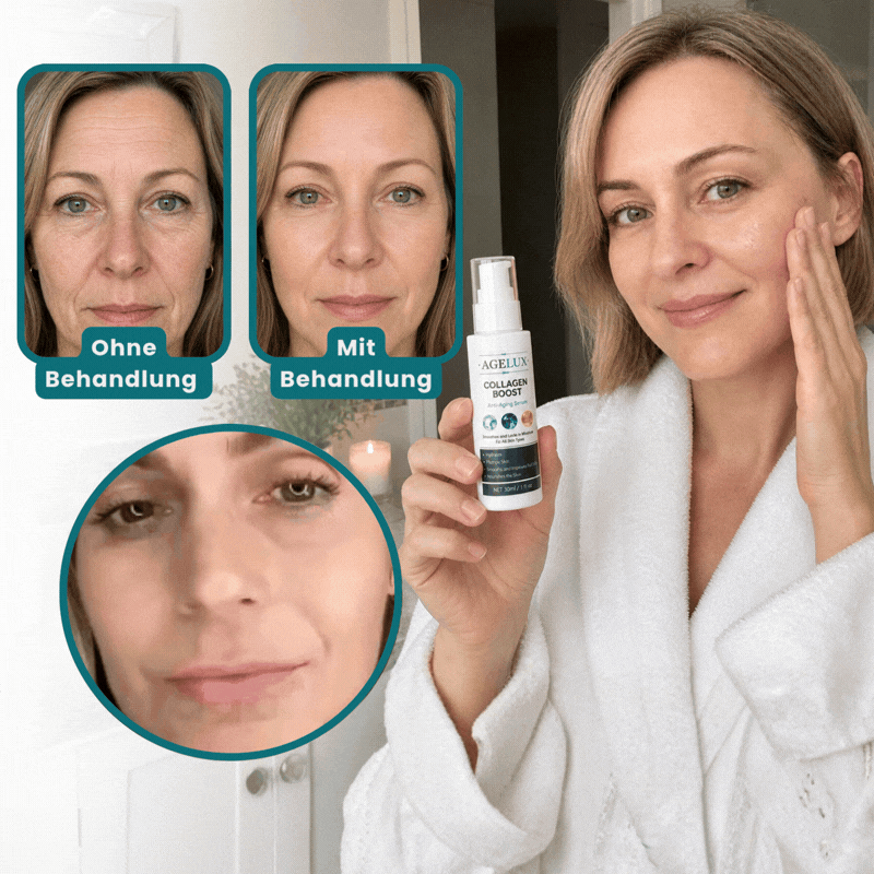 Agelux™ Collagen Boost Anti-Aging-Serum | Glätte Falten sichtbar in nur 3 Wochen