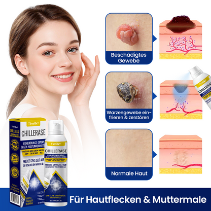 1+1 GRATIS | ChillErase Erneuerungs-Spray gegen Hautunreinheiten