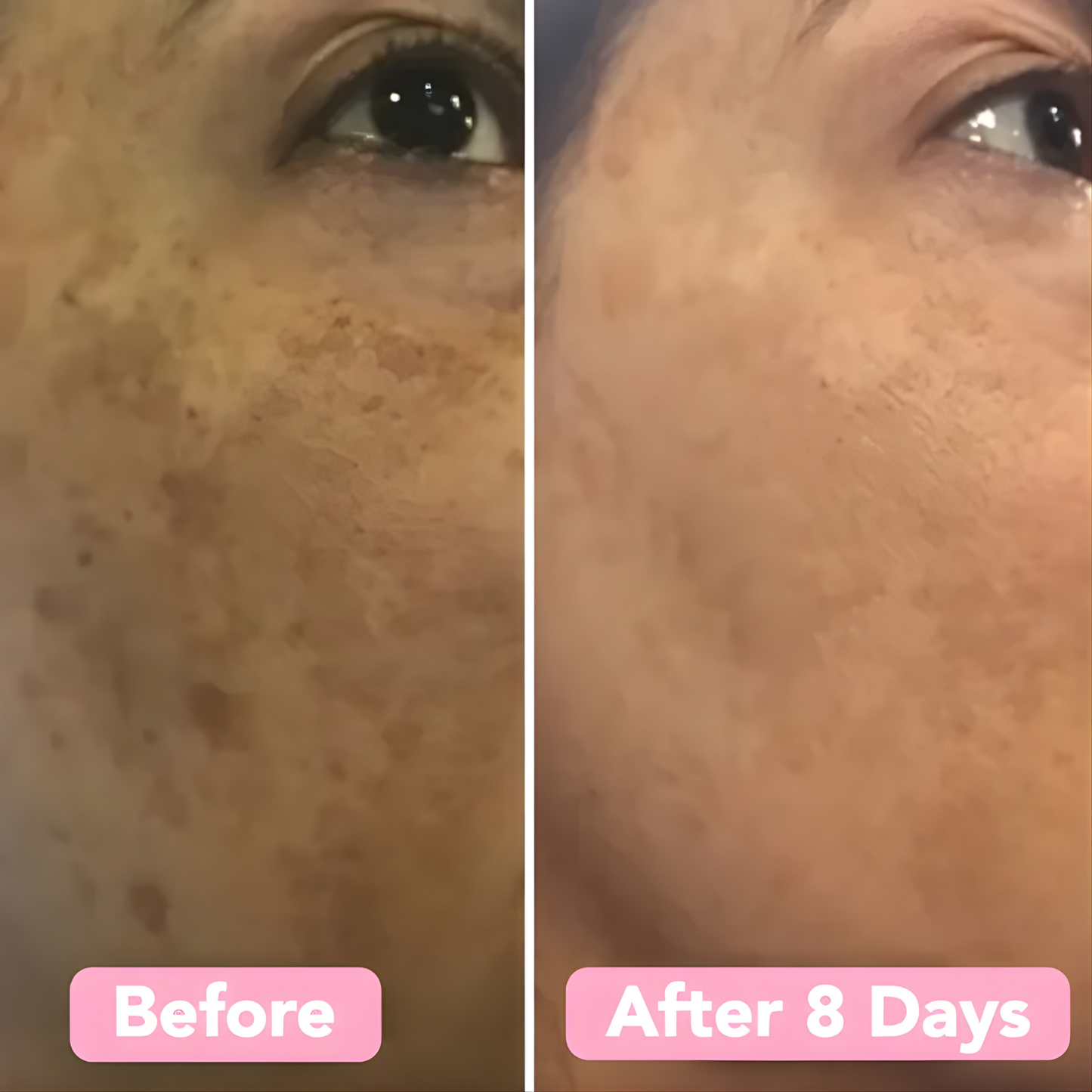 LumaSkin Radiance Pads — Peeling-Gesichtspads