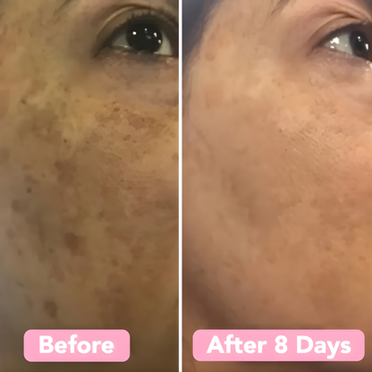 LumaSkin Radiance Pads — Peeling-Gesichtspads