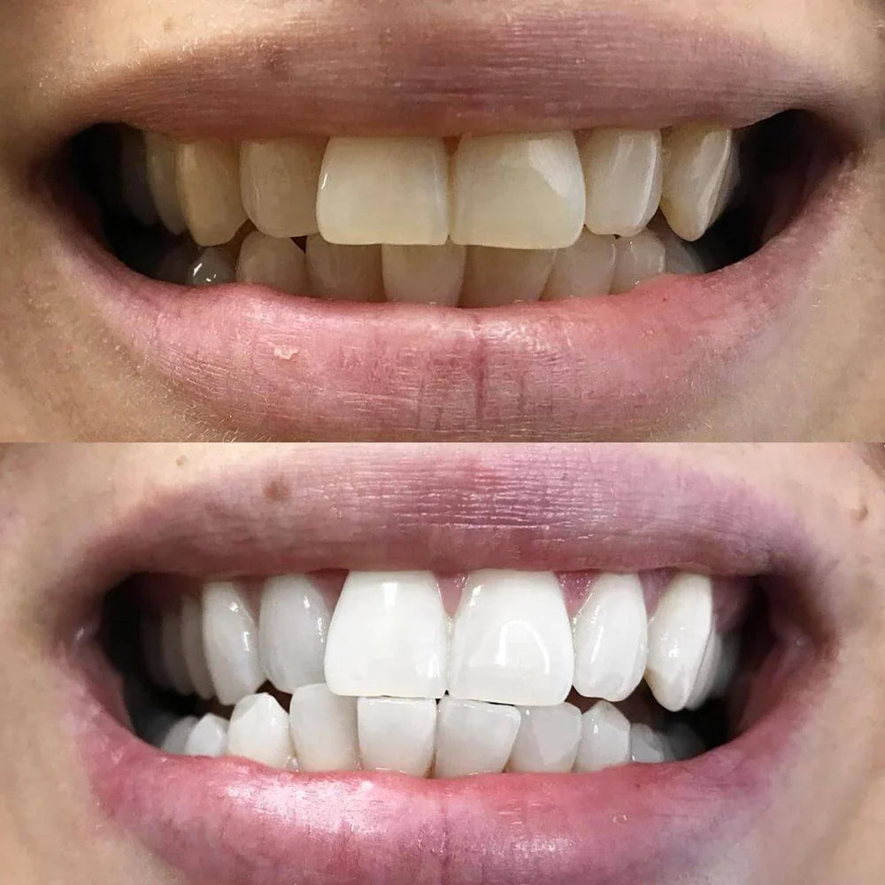 DrSmile™ – Strahlen Sie mit einem Lächeln, das jeden Raum beherrscht [1 + 1 Gratis]
