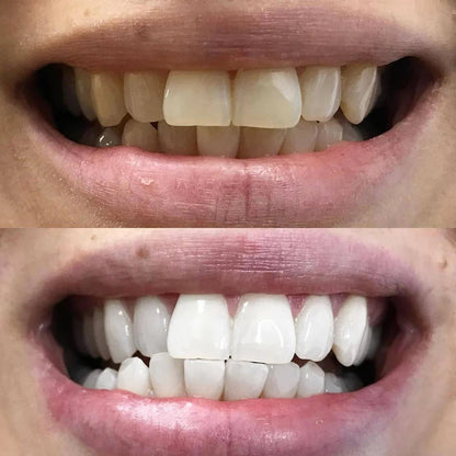 DrSmile™ – Strahlen Sie mit einem Lächeln, das jeden Raum beherrscht [1 + 1 Gratis]