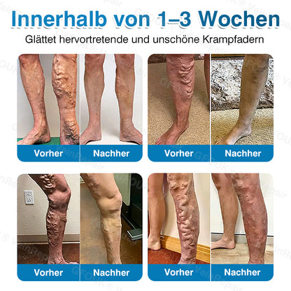 GFOUK® VeinRepair Mikronadel-Pflasterrolle⚡