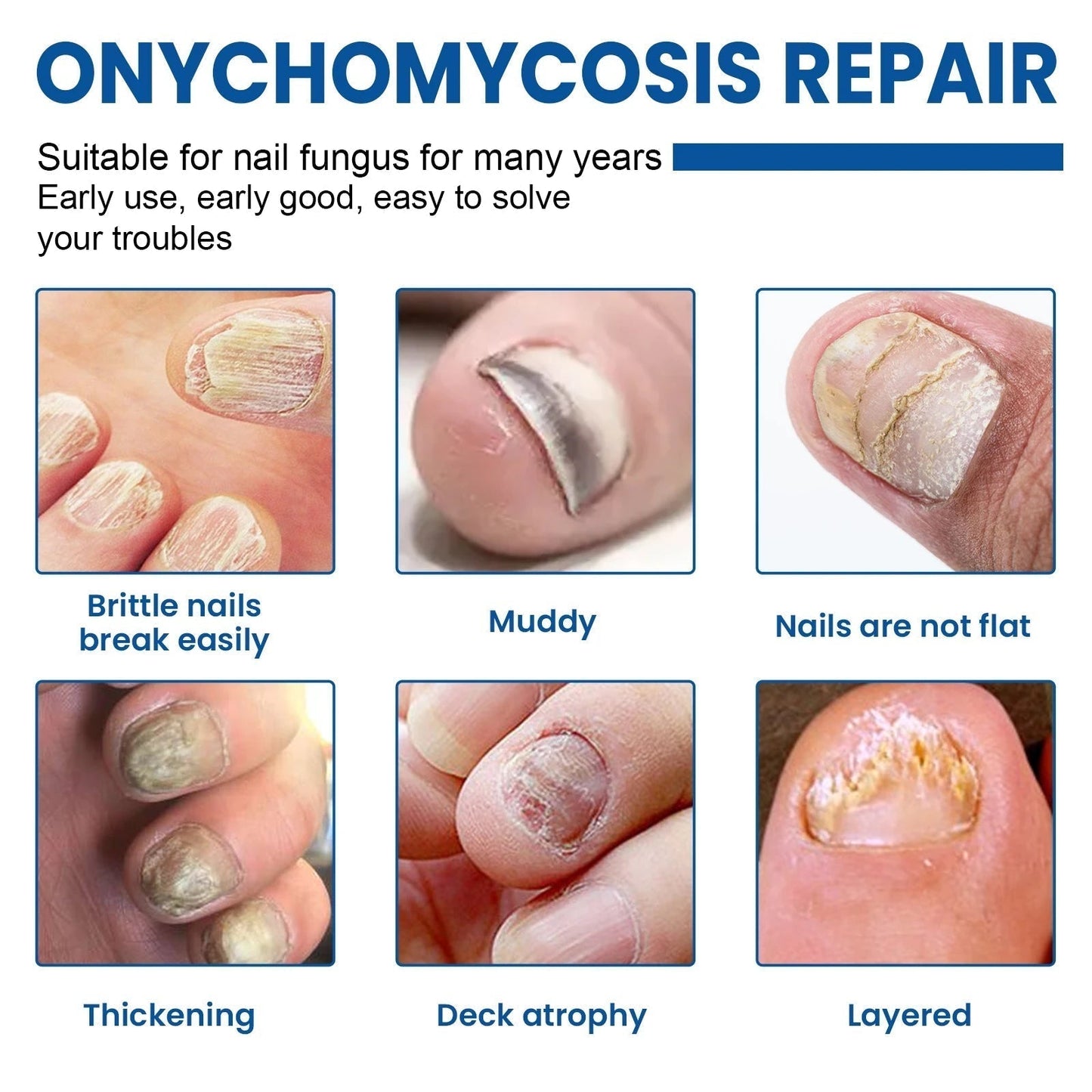 Nagelpflege-Reparatur-Patches für beschädigte und verfärbte Nägel