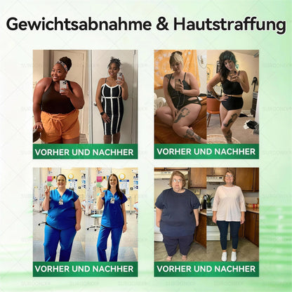𝗠𝗼𝗿𝗶𝗻𝗴𝗮 · 𝗕𝗲𝗿𝗯𝗲𝗿𝗶𝗻 & NAD+ 10-in-1 Fortschrittliches Nano-Mikronadel-Pflaster – Für die tägliche Unterstützung von Stoffwechsel und Herz-Kreislauf-Gesundheit