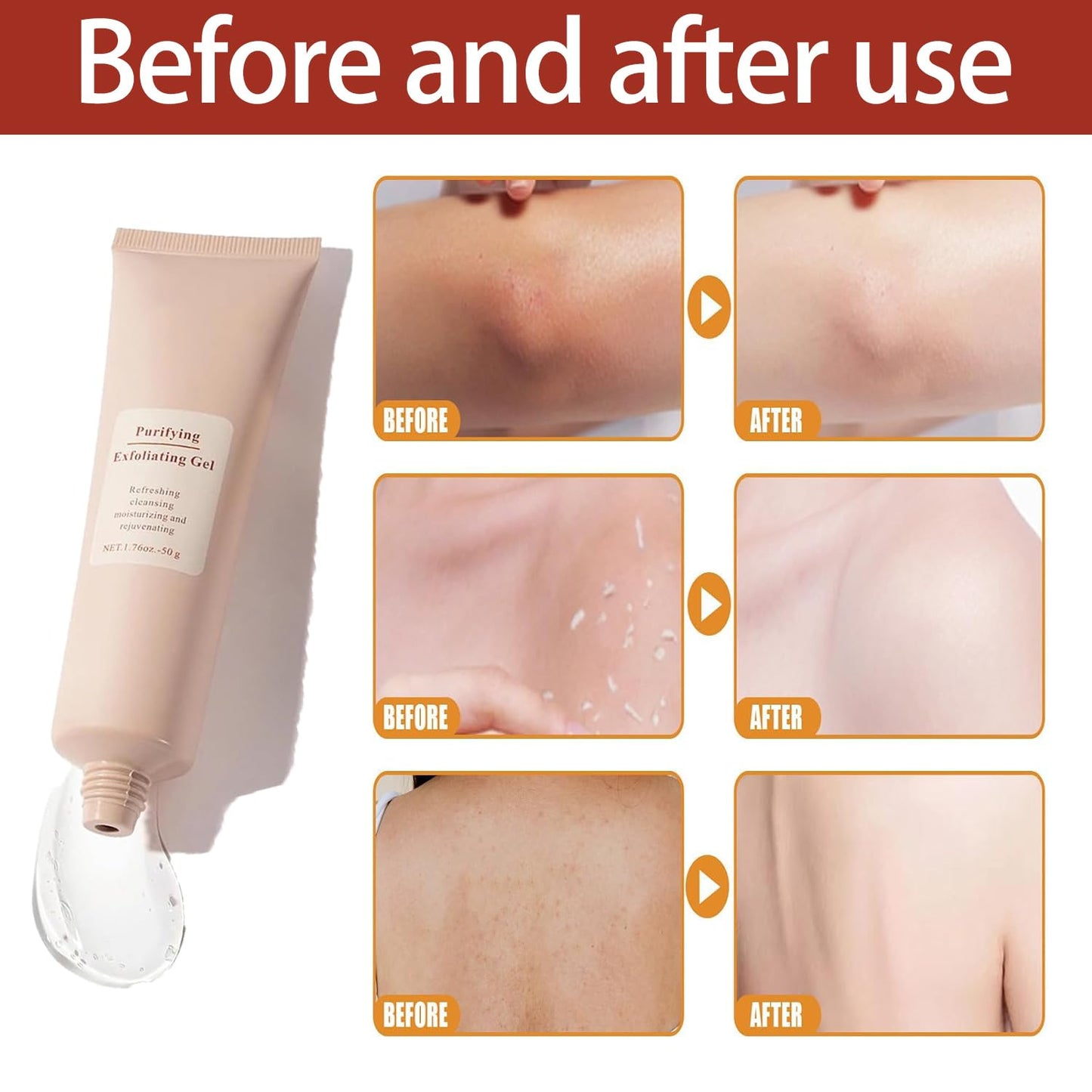LumaLift Radiance — Exfolierendes Gel-Gesichtspeeling für glattere, erfrischte Haut