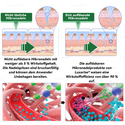 𝗠𝗼𝗿𝗶𝗻𝗴a · 𝗕erberin ＆ NAD＋10-IN-1 𝗙ortschrittliches 𝗡ano-Mikronadel-𝑷𝒇𝒍𝒂𝒔𝒕𝒆𝒓 - Für Adipositas, Herz-Kreislauf-Gesundheit, Diabetes, Schlafapnoe, Gelenkprobleme u.v.m.
