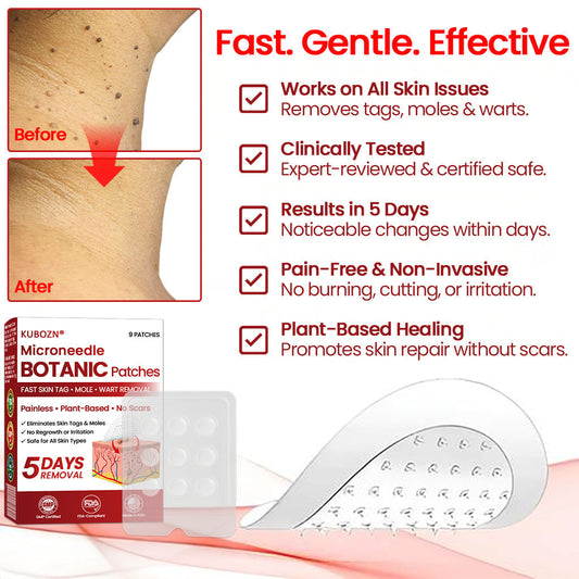 SkinClear™ Mikronadel-Pflaster zur Hautanhängsel-Entfernung – Für Glattere Haut