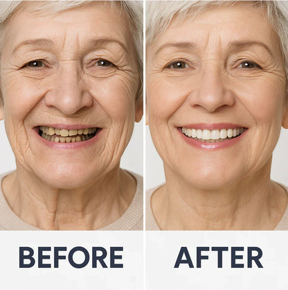 Kosmetik-Zahnersatz mit Komfort-Passform – herausnehmbares Smile-Set