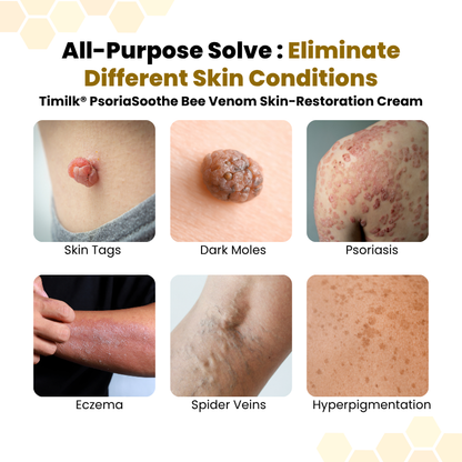 Alcuras® PsoriaSoothe – Hautregenerierende Creme mit Bienengift