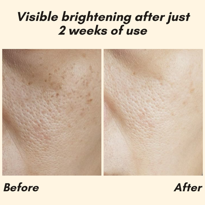 HOYGI – Eternity Vitamin‑C‑Serum für Gesicht, Hände & Körper