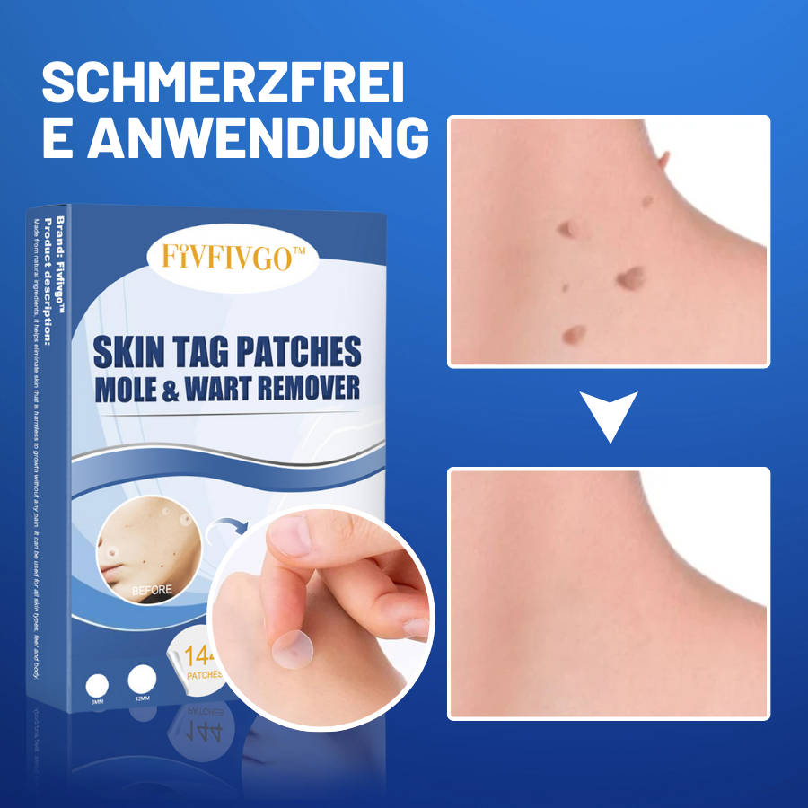 TagAway™ – Hautanhänger-Entfernungspflaster | Entfernt Skin Tags schmerzfrei in 7 Tagen