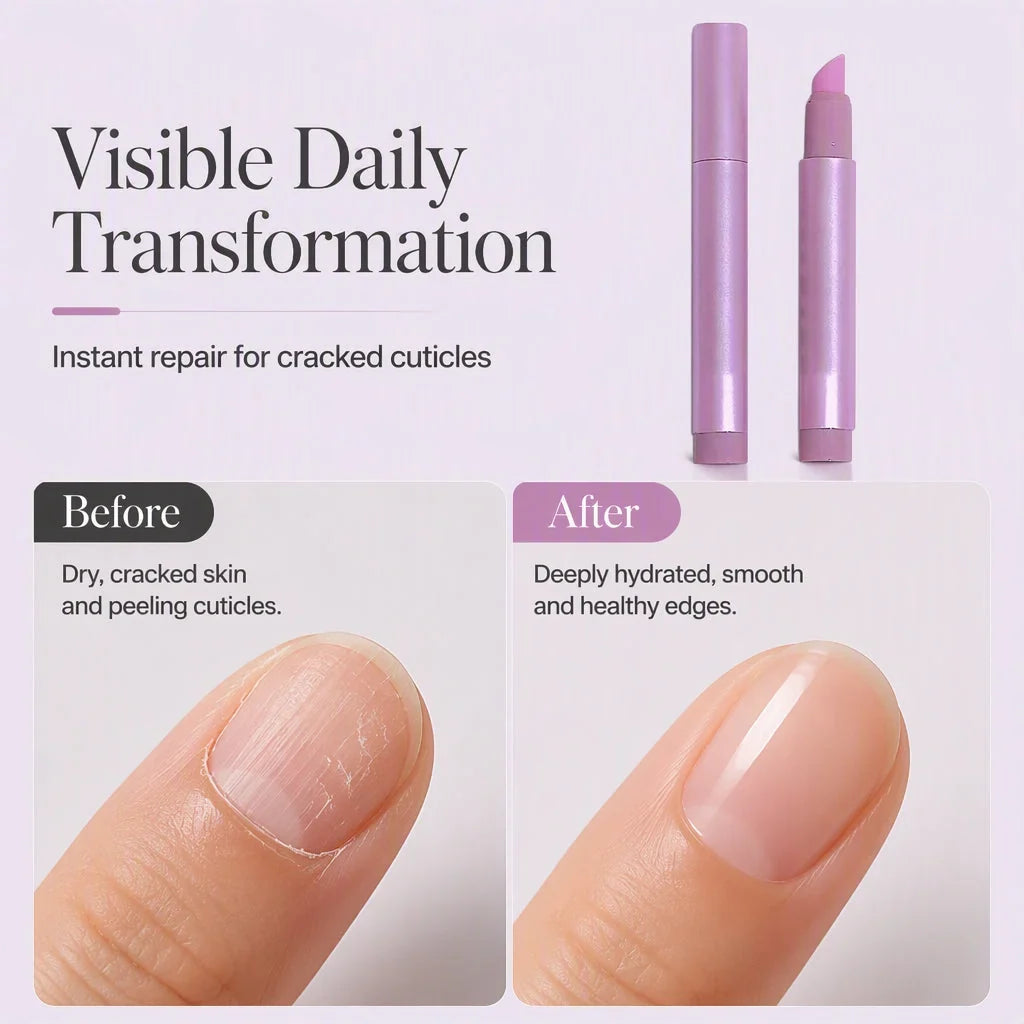 SilkNail Pen – Geschmeidige Nägel & gepflegte Nagelhaut im Handumdrehen!