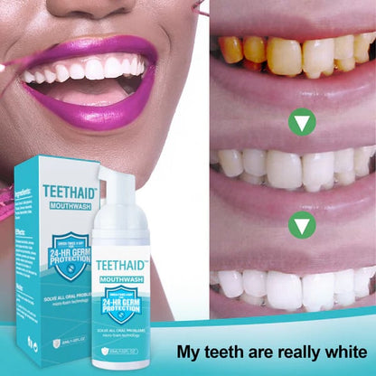 BrightMint™ Premium Mundspülung – Für Frischen Atem & Strahlend Gepflegte Zähne