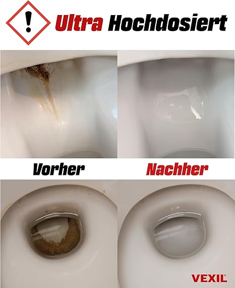 VEXIL® Urinsteinentferner EXTRA STARK - 1000 ml | 50% Rabatt
