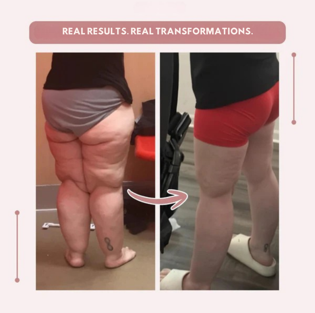 AquaLure — High-Waist-Kompressionsleggings