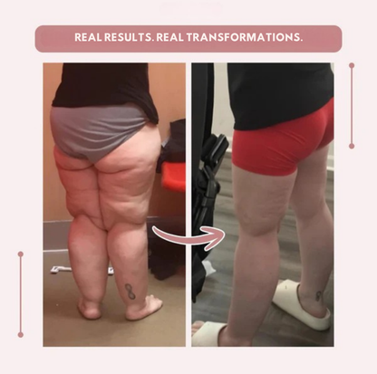 AquaLure — High-Waist-Kompressionsleggings