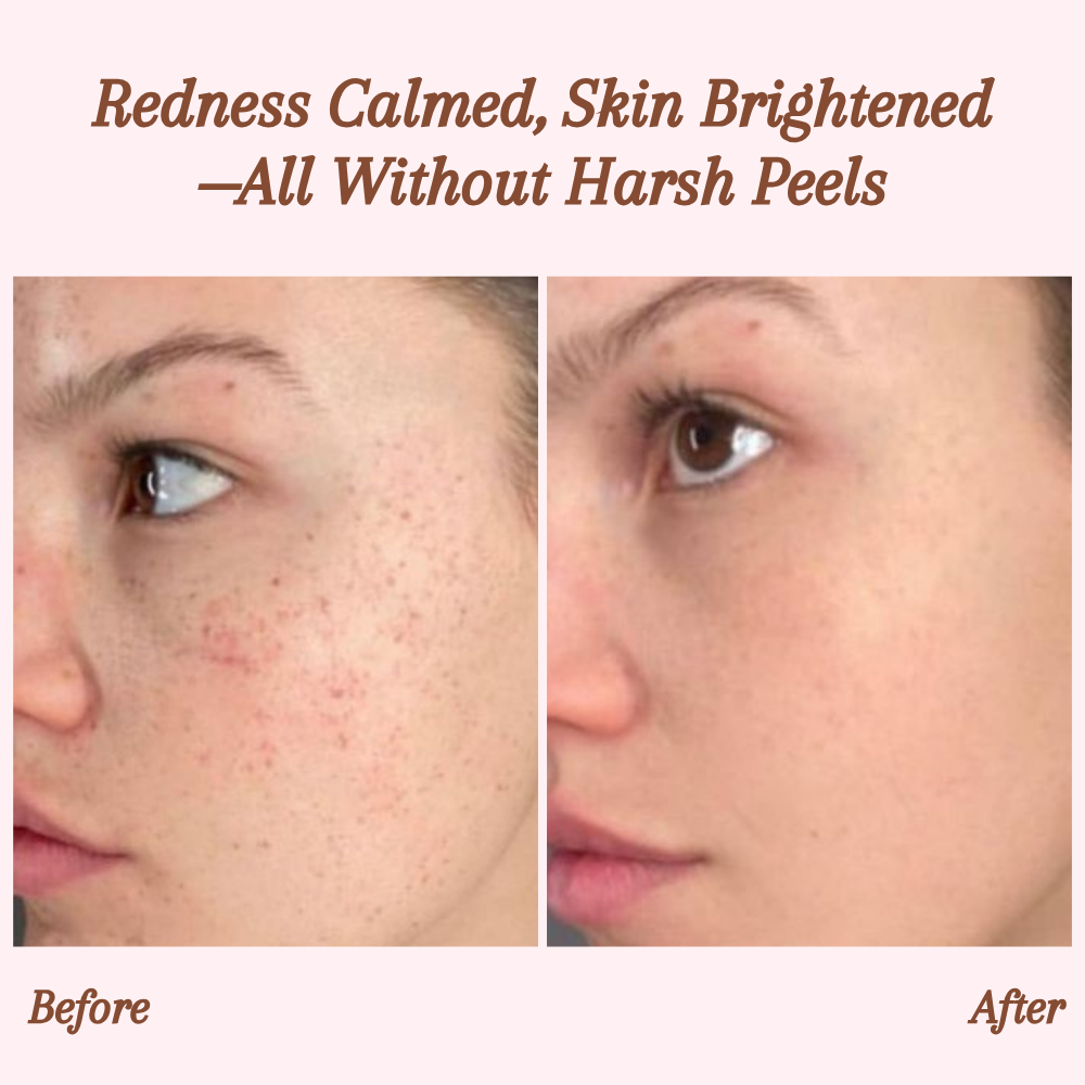 RevitaDerm — Sanftes Peeling-Gel für die tägliche Hautpflege