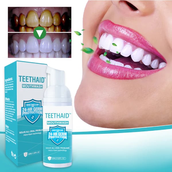 BrightMint™ Premium Mundspülung – Für Frischen Atem & Strahlend Gepflegte Zähne