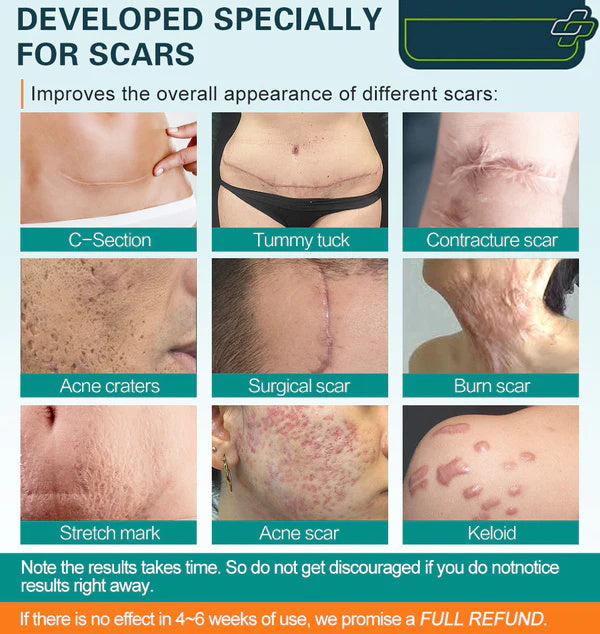 ScarSpray™ – Lässt Narben & Hautmale sichtbar verblassen [Heute 50 % Rabatt]