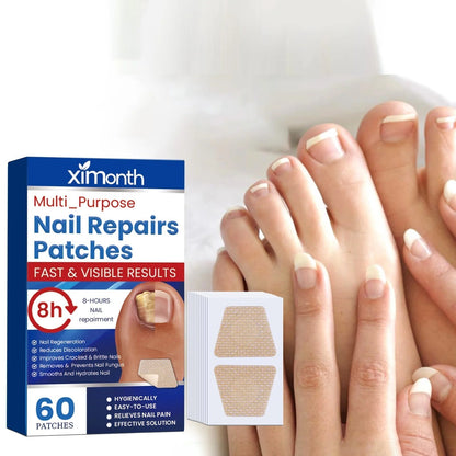Nagelpflege-Reparatur-Patches für beschädigte und verfärbte Nägel