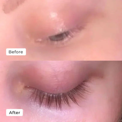 1+1 Gratis | Wimpernserum™ - Geben Sie dünnen, kurzen Wimpern Schwung