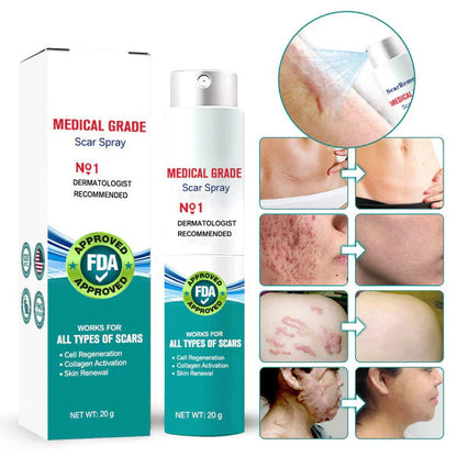 ScarSpray™ – Lässt Narben & Hautmale sichtbar verblassen [Heute 50 % Rabatt]