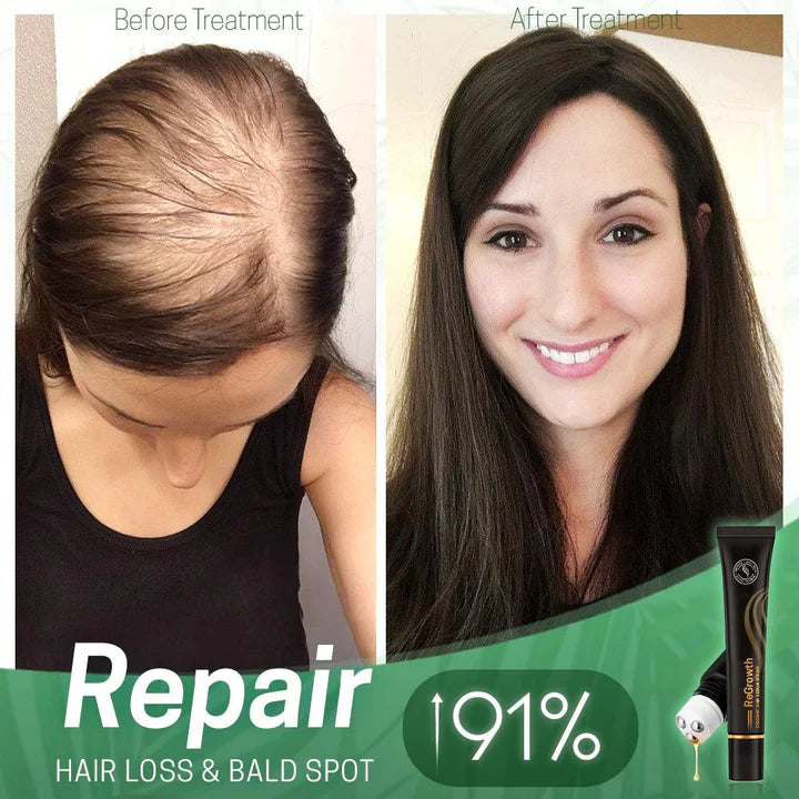 StrandSurge Serum — Haarwuchs-Serum mit Roller-Applikator