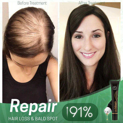 StrandSurge Serum — Haarwuchs-Serum mit Roller-Applikator