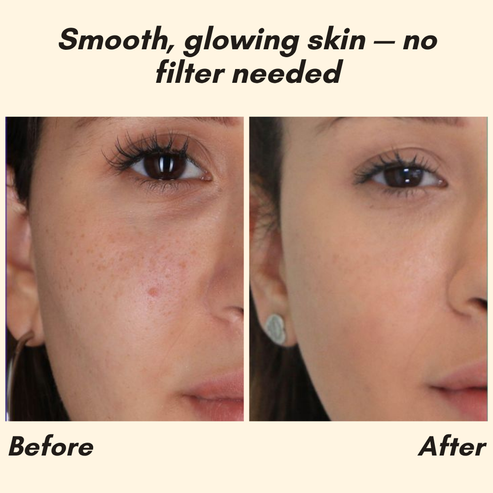 HOYGI – Eternity Vitamin‑C‑Serum für Gesicht, Hände & Körper