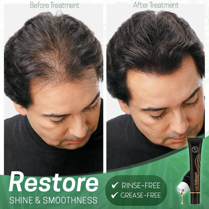 StrandSurge Serum — Haarwuchs-Serum mit Roller-Applikator